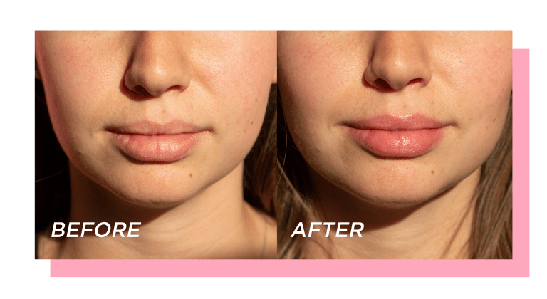 Glow Recipe  Watermelon Glow Lip Pop